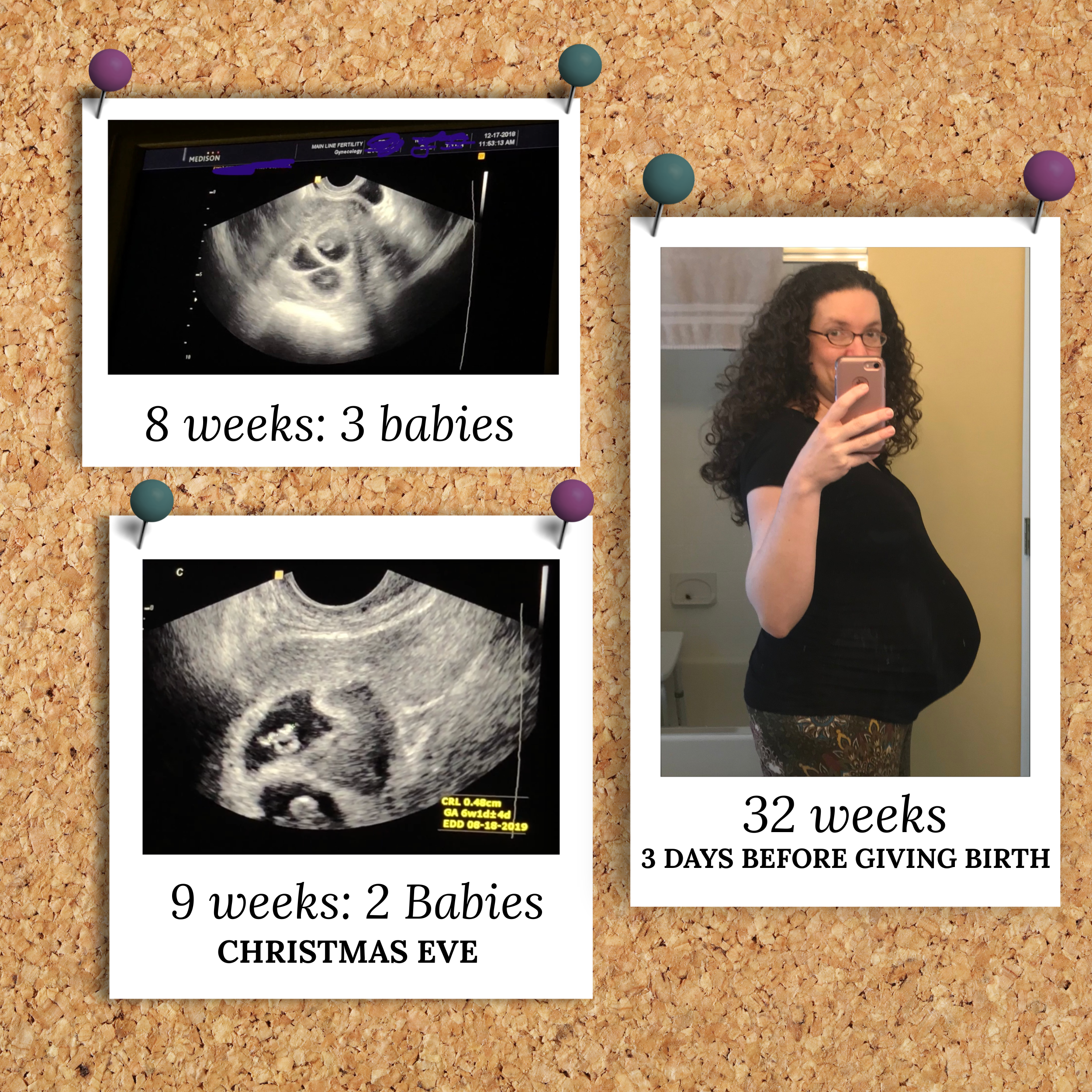 Cara's Pregnancy Bulletin Board 2